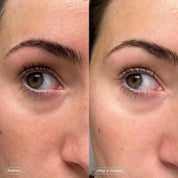 Brightening Facial Mask for Dark Circles - GlamourStore26